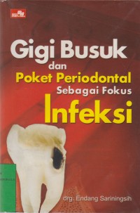 Image of Gigi Busuk Dan Poket Periodonotal Sebagai Fokus Infeksi